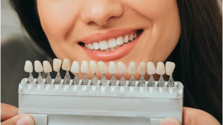 Boutique Whitening: The Ultimate Guide to a Brighter, Healthier Smile boutique whitening